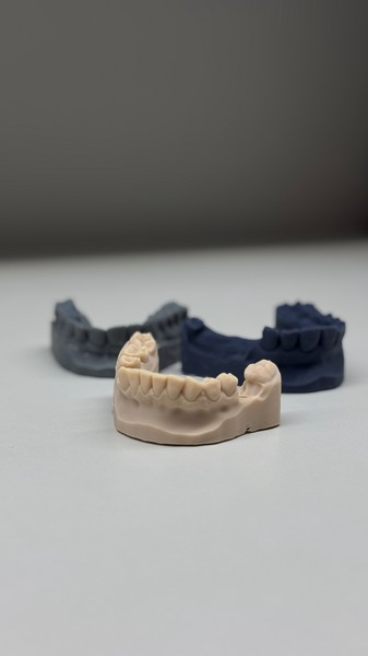 Временные коронки 2